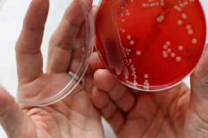 An employee displays MRSA (Methicillin-resistant Staphylococcus aureus) bacteria strain inside a petri dish containing agar jelly for bacterial culture. (Reuters / Fabrizio Bensch) <br/>