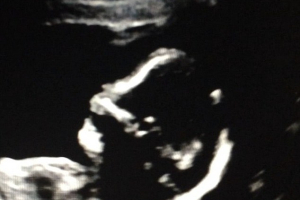 Jessa Duggar shared a photo of her unborn baby via Instagram on Sunday. <br/>Instagram/ Jessa Seewald