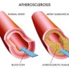 Understanding cholesterol