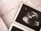 Baby Heartbeat, Ultrasound Image