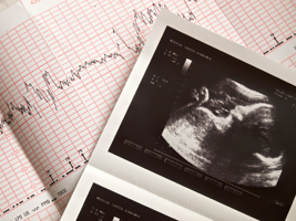 An ultrasound image of the baby and a cardiogram of the baby's heartbeat. iStockphoto.com/liseykina <br/>