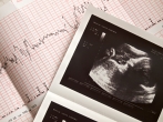 Baby Heartbeat, Ultrasound Image