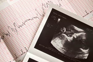 An ultrasound image of the baby and a cardiogram of the baby's heartbeat. iStockphoto.com/liseykina <br/>