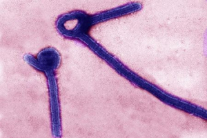 A transmission electron micrograph shows Ebola virus particles in this undated handout image released by the U.S. Army Medical Research Institute of Infectious Diseases (USAMRIID) in Fredrick, Maryland.  <br/>REUTERS/USAMRIID/Handout