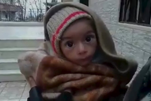 A toddler is held up to the camera in this still image taken from video said to be shot in Madaya on January 5, 2016.  <br/>Handout via Social Media Website