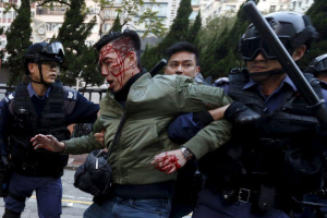 An unidentified injured man is escorted by riot police at Mongkok in Hong Kong, China February 9, 2016. REUTERS/Bobby Yip <br/>