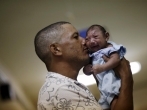 Zika virus and microcephaly among babies in Brazil