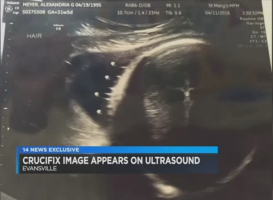 A sonogram of Aley Meyer's baby boy appears to show an image of Jesus on the cross, with video posted on April 20, 2016. Photo: Fox14 News<br />
 <br/>