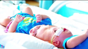 Anias and Jadon McDonald, twin boys who were recently surgically separated.  <br/>