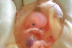 Human fetus 10 weeks with amniotic sac <br/>Wikimedia Commons
