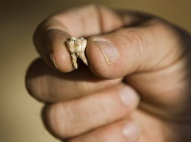 Professor Avi Gopher from the Institute of Archeology of Tel Aviv University holds an ancient tooth that was found at an archeological site near Rosh Haain, central Israel, Monday, Dec. 27, 2010. <br/>AP Images / Oded Balilty