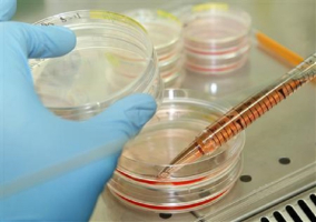 A researcher works in his laboratory at the Institute for Stem cell Therapy and Exploration of Monogenic Diseases (I-Stem) in Evry, near Paris November 27, 2009. The team has succeeded in grafting epidermis from human embryonic stem cells onto mice in order to produce temporary skin substitutes for patients awaiting skin grafts. <br />
 <br/>Reuters/Gareth Watkin