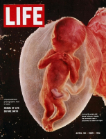 The Drama of Life Before Birth” <br/>AP Photo