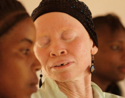 The Tanzania Albinism Collective recorded a 23-track album, White African Power, that will be available for download starting on June 2. <br/>Tanzania Albinism Collective
