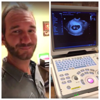 On Father's Day, evangelist Nick Vujicic announced via Facebook he and his wife are expecting twins. <br/>Facebook/ScreenGrab
