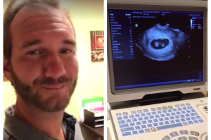 On Father's Day, evangelist Nick Vujicic announced via Facebook he and his wife are expecting twins. <br/>Facebook/ScreenGrab
