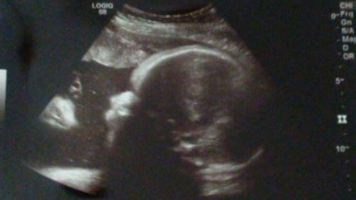 The Tennessee couple saw Jesus in the far left of their sonogram. <br/>Facebook