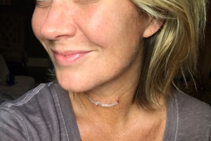 Natalie Grant is praising God after revealing the surgery she underwent to remove cancer risk did not damage her vocal chords. <br/>Facebook