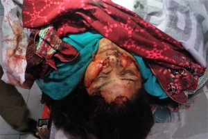 Body of Firdous Masih after attack in Quetta, Pakistan.  <br/>Morning Star News