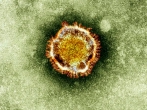 The MERS virus