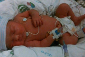 Faith was born via C-section at 35 weeks after her mother spent most of her pregnancy in a coma. (AP) <br/>
