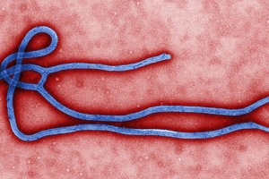 This colorized transmission electron micrograph image shows some of the ultrastructural morphology of an Ebola virus virion. (Photo credit: Wikipedia) <br/>
