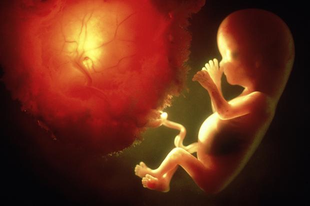 Fetus Abortion