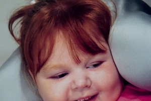 Nancy, 12, suffered from a debilitating disease that left her unable to walk, talk, or eat independently. Picture shows her at age 4. (SWNS) <br/>