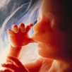 Unborn Babies (Abortion)