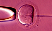 'Three Parents' DNA IVF Technique