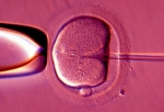 'Three Parents' DNA IVF Technique
