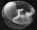Unborn Baby