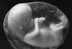 Unborn Baby