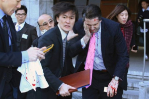 U.S. ambassador to South Korea Mark Lippert leaves after he was slashed in the face by an assailant at a public forum in central Seoul, March 5, 2015. Reuters <br/>